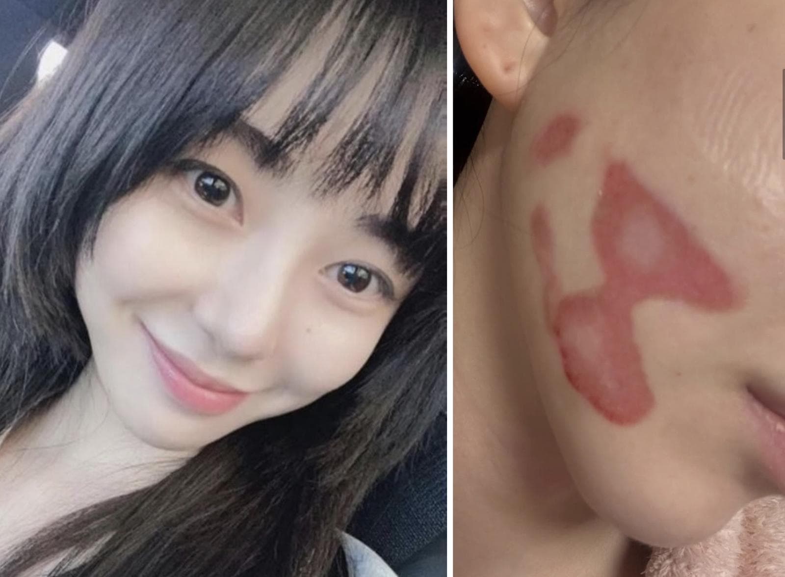 권민아, 모친 위독 소식과 친언니 갈등... AOA 괴롭힘 재언급까지