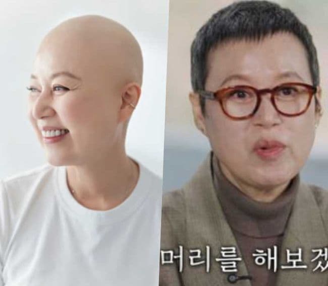 박미선 — 민머리 프로필 공개..박미선, '유방암' 전조증상 어땠길래 핫피플